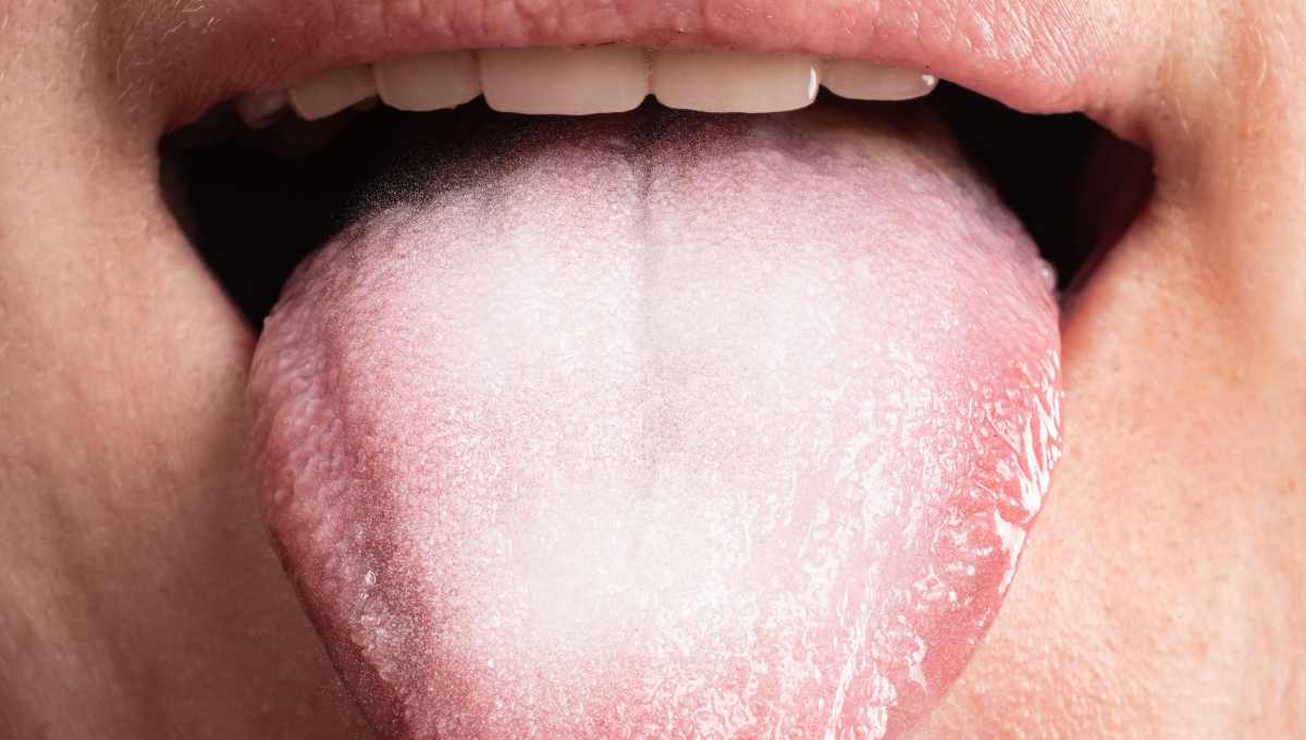 舌苔とは？なかなか取れない舌苔の成分、除去するための取り方