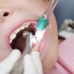 小児歯科と一般歯科の違いとは?適切な診療科を知ろう