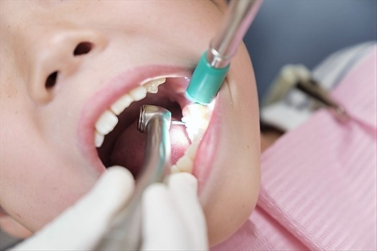 小児歯科と一般歯科の違いとは？適切な診療科を知ろう