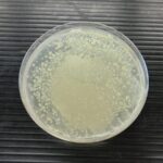 口臭の原因になる細菌の種類(名前)と特性・生成する悪臭成分