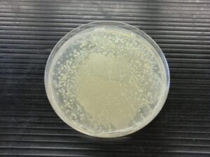 口臭の原因になる細菌の種類（名前）と特性・生成する悪臭成分